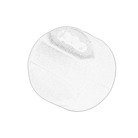 Buson, rezervor (injectie aditiv) AdBlue tank cap CITROEN C3 AIRCROSS II C3 III C4 CACTUS C4 GRAND PICASSO II C4 PICASSO II C4 SPACETOURER C5 AIRCROSS OPEL ASTRA L GRANDLAND / GRANDLAND X 1.4D-2.0D 02.13- OE PEUGEOT 9813850980